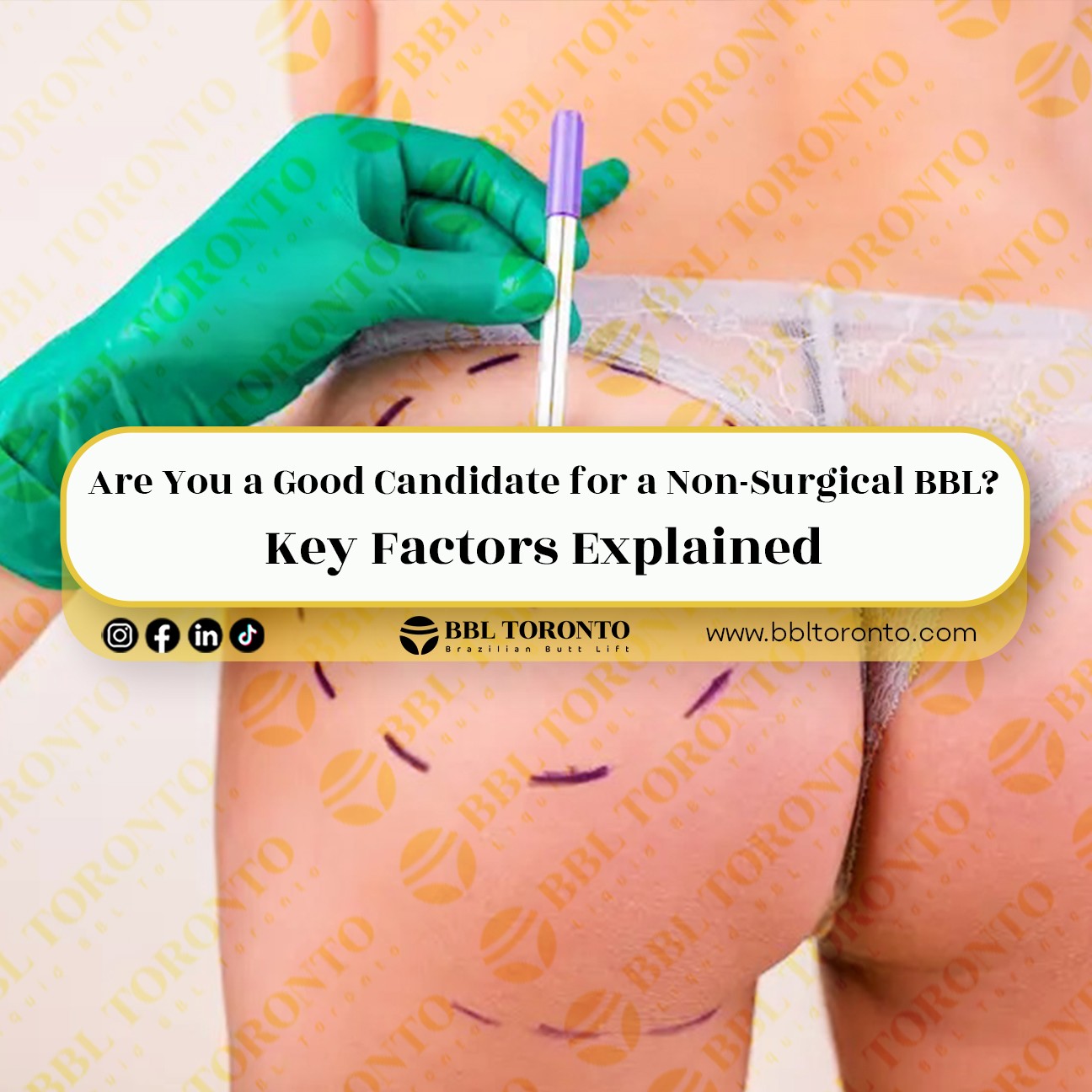 Are You a Good Candidate for a Non-Surgical BBL? Key Factors Explained