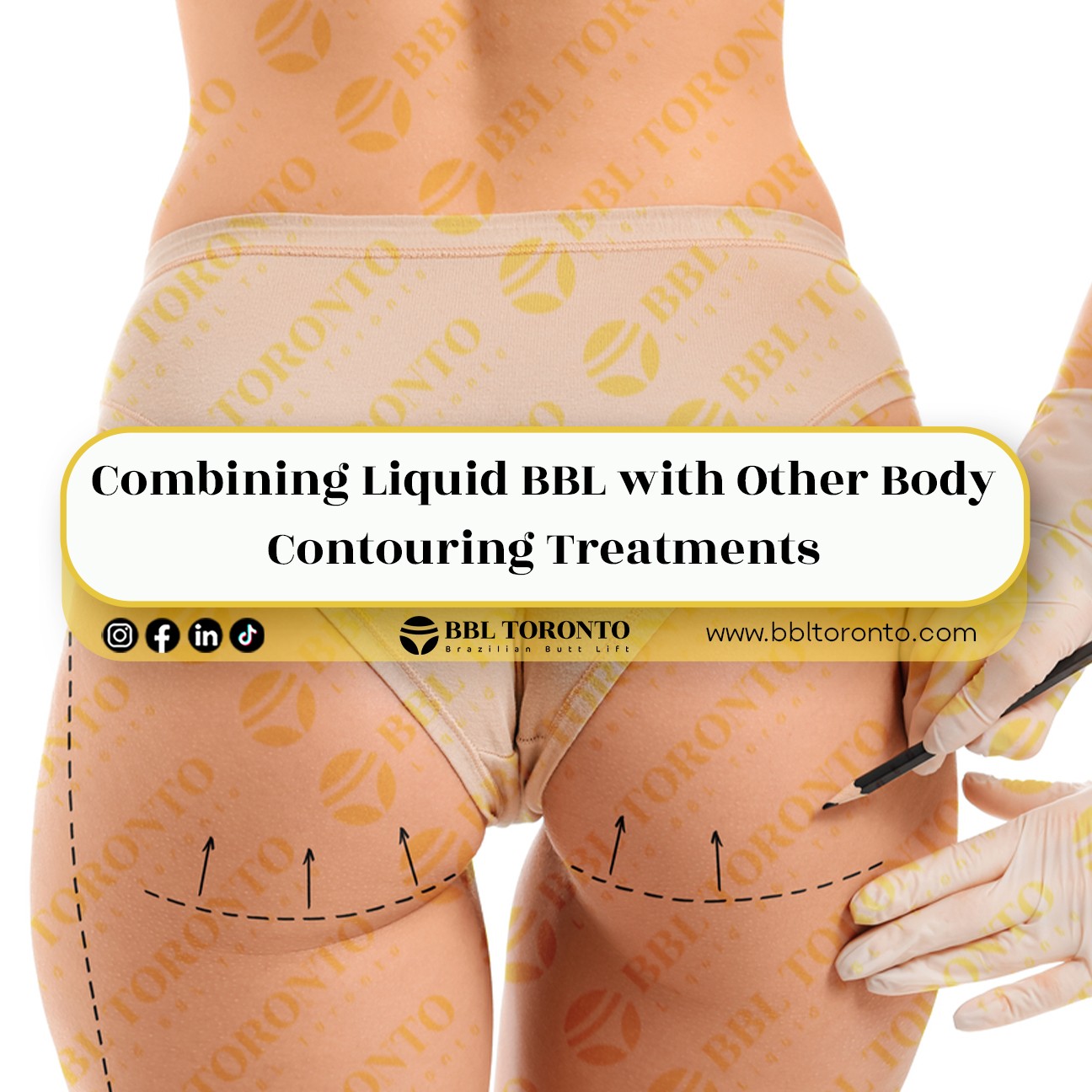 Combining-Liquid-BBL-with-Other-Body-Contouring-Treatments