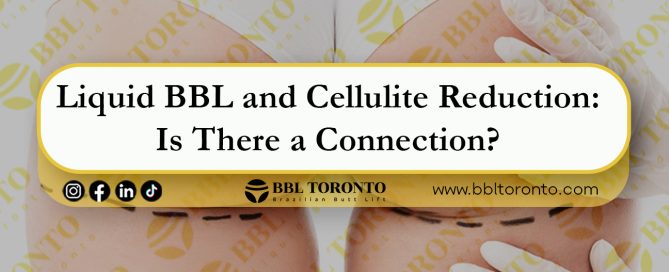 Liquid-BBL-and-Cellulite-Reduction--Is-There-a-Connection