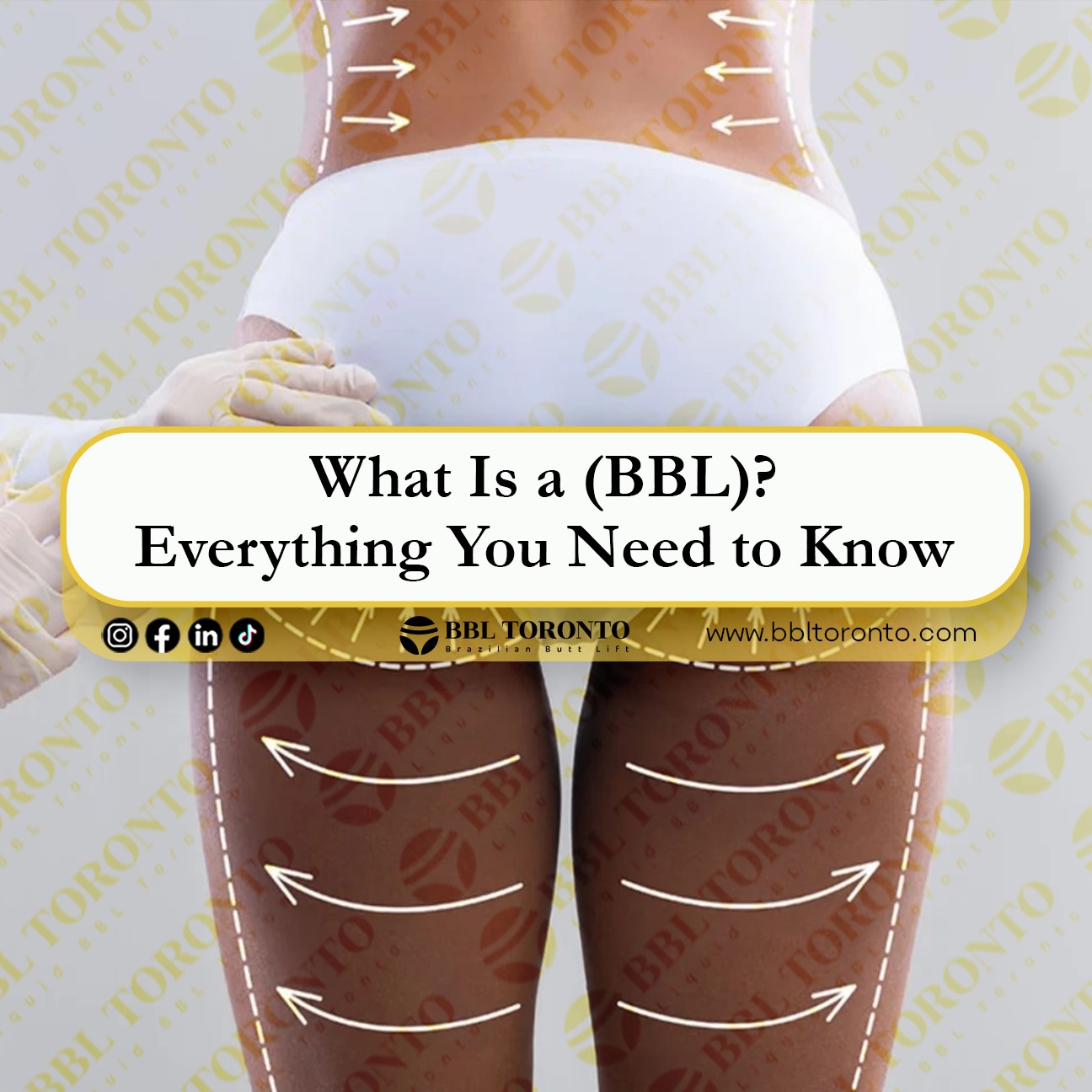 What Is A BBL Everything You Need To Know Liquid BBL Toronto Non 