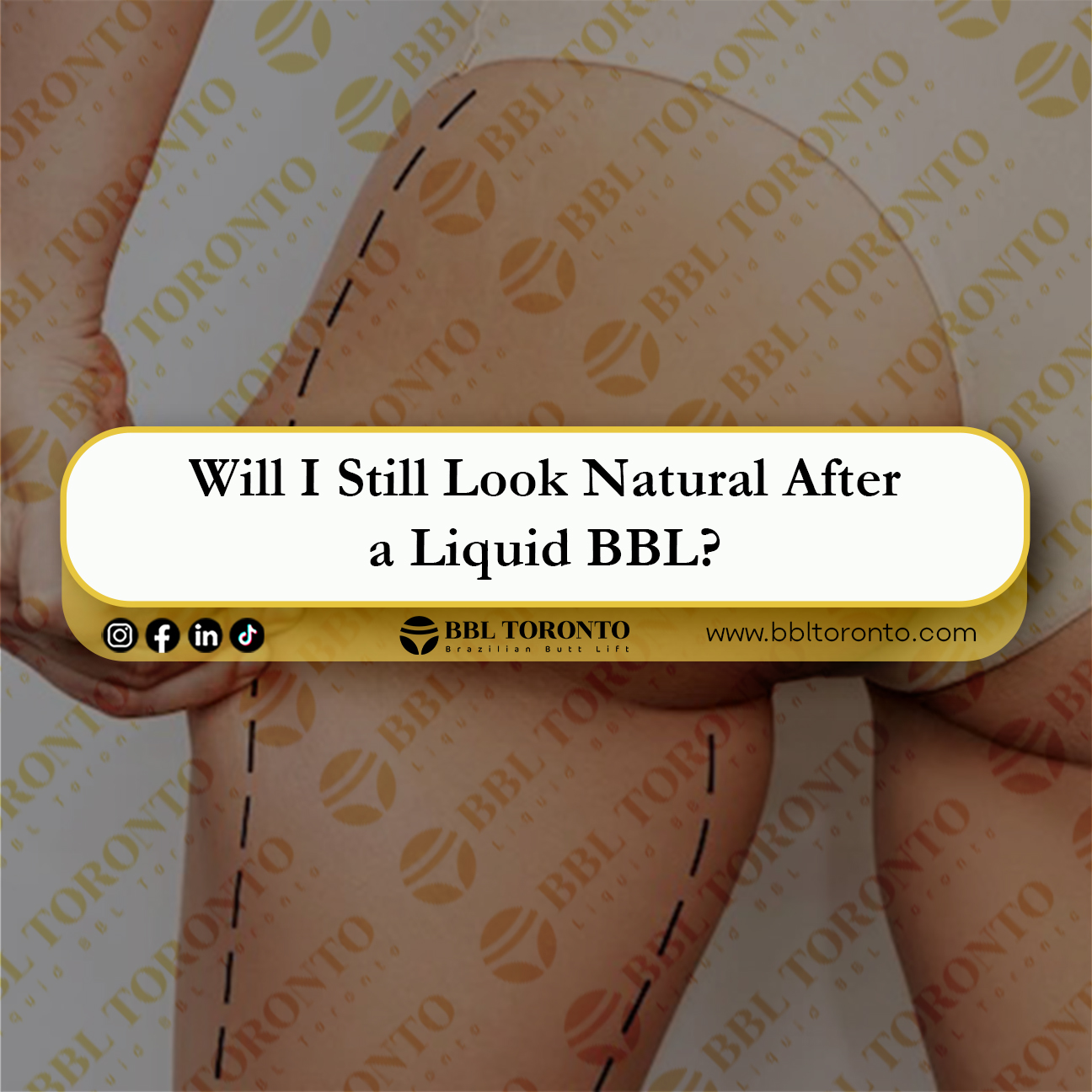 Will-I-Still-Look-Natural-After-a Liquid BBL