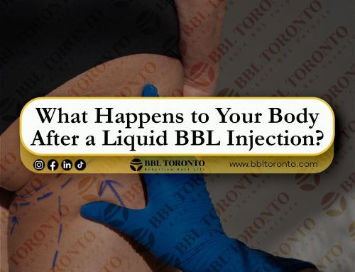 What Happens to Your Body After a Liquid BBL Injection?