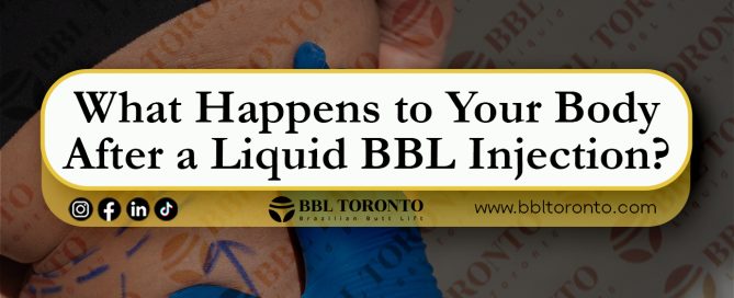 What-Happens-to-Your-Body-After-a-Liquid-BBL-Injection