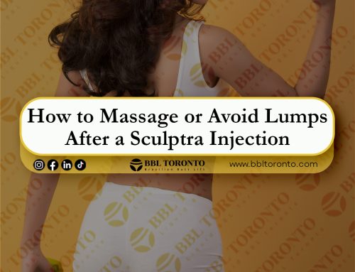 How to Massage or Avoid Lumps After a Sculptra Injection