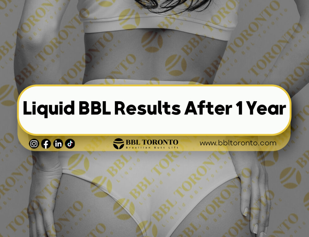 What Is a (BBL)? Everything You Need to Know - Liquid BBL Toronto | Non ...