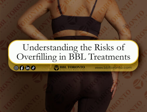 Understanding the Risks of Overfilling in BBL Treatments